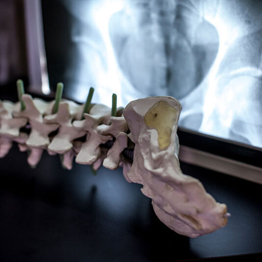 osteoarthritis-treatment